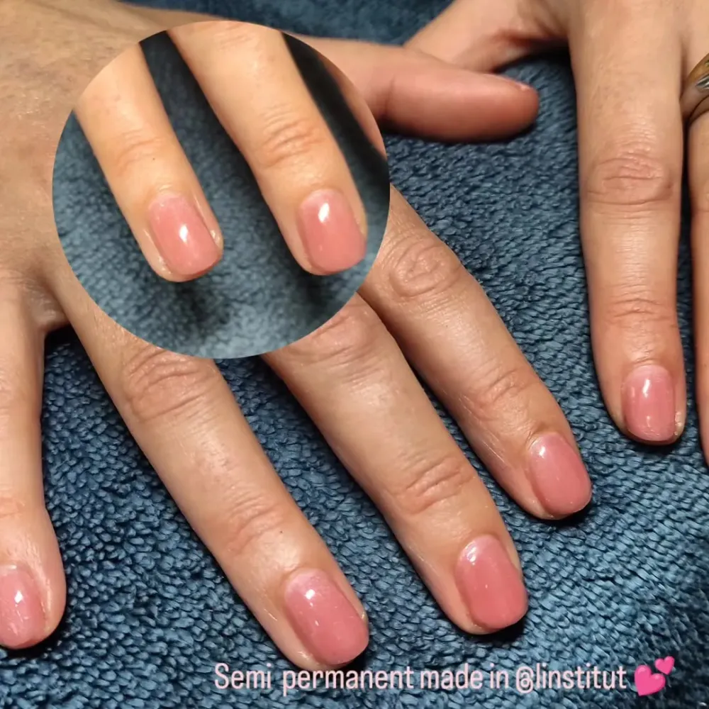 ongle